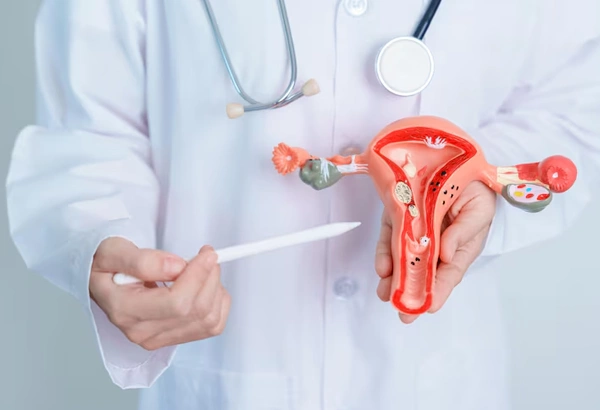 Fibroids Treatment