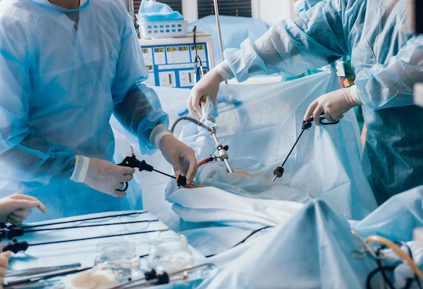 Laparoscopic Gynaecological Surgery